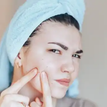 Kerap Disangka Sama, Ini Perbedaan Fungal Acne dan Bruntusan