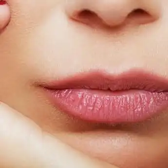 5 Penyebab Utama Bibir Kering, Dokter: Gara-gara Kebiasaan Buruk!