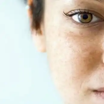 Nyesel Banget Beli Skincare Mahal, Flek Hitam Seketika Bisa Hilang Hanya dengan Pisang Saja, Gimana Caranya?