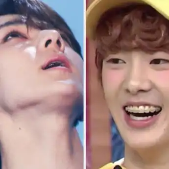11 Idol K-Pop yang Dulunya Punya Kawat Gigi, Tetap Menggemaskan!
