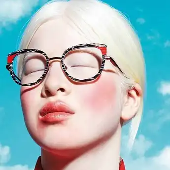7 Potret Model Albino Xue Li yang Dibuang Orang Tuanya Sendiri