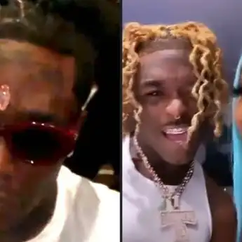Lil Uzi Vert Mencabut Berlian Rp 342 Miliar yang Ditanam di Dahinya