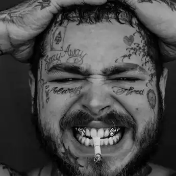 Post Malone Veneer Gigi dengan Berlian Seharga Rp 22,7 Miliar!