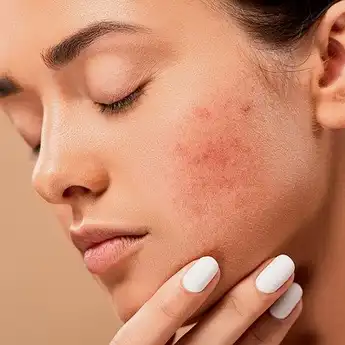 Percuma Skincare-an kalau Kebiasaan Sepele Ini Masih Dilakukan, Bikin Kusam!