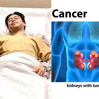 KABAR DUKA! Vidi Aldiano Kini Hidup dengan Satu Ginjal, Ibu-ibu Ingatkan Suami Hindari Aktivitas Ini Agar Bebas dari Kanker Ginjal