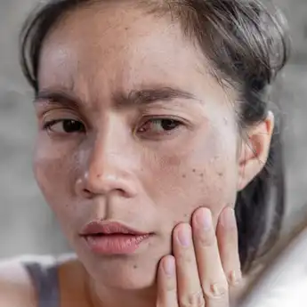 Percuma Pakai Skincare Mahal, Lewat Bahan Alami Ini Wanita Auto Cantik karena Flek Hitam Pudar Seketika
