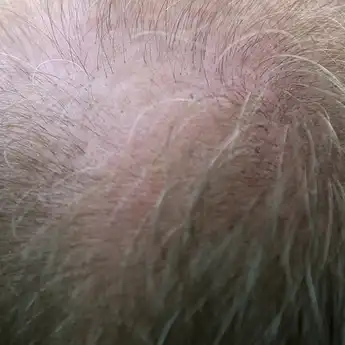 Duh Nyesel Banget Selama Ini Dicabutin, Ternyata Uban Bisa Lenyap hanya dengan Satu Bahan Ini Doang
