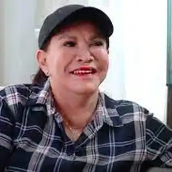 Kabar Duka! Wajah Mpok Atiek Rusak Hingga Tak Laku di TV, Ternyata Penyebabnya Gara-gara Suntik di Bagian Ini...