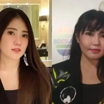 7 Artis Indonesia yang Gagal Operasi Plastik, Bukannya Makin Oke Malah Bikin Kapok!