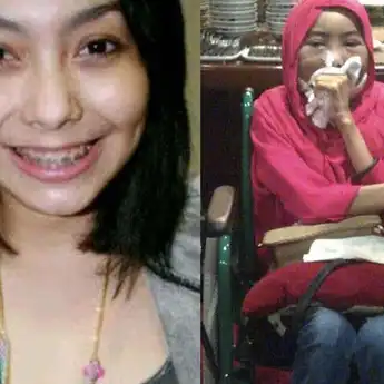 Belajar dari Artis Cantik Cecillia Putty yang Meninggal karena Kanker Lidah, AWAS Ini 10 Ciri Kanker Lidah yang Sering Tak Disadari