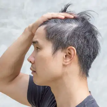 Masih Muda Sudah Ubanan? Begini Cara Mengatasinya