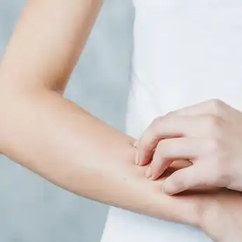Cara Mengatasi Alergi Obat dengan Tepat, Jangan sampai Salah Langkah!
