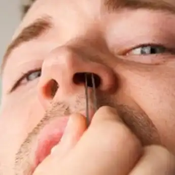 Bikin Mimisan ! Berikut 4 Bahaya Mencabut Bulu Hidung               
