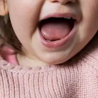 5 Perbedaan Lidah Normal dan Tongue Tie, Orang Tua Wajib Tahu!