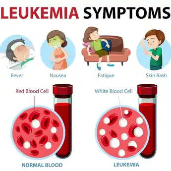 Seberapa Bahayanyakah Leukimia?