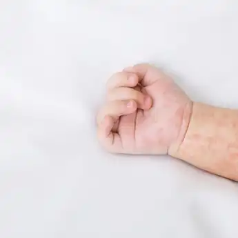 Perbedaan Campak dan Alergi yang Perlu Diketahui! Jangan Sampai Keliru