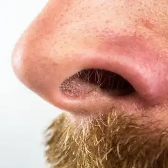 Bisa Bikin Asma, Berikut Ini 6 Bahaya Mencabut Bulu Hidung!