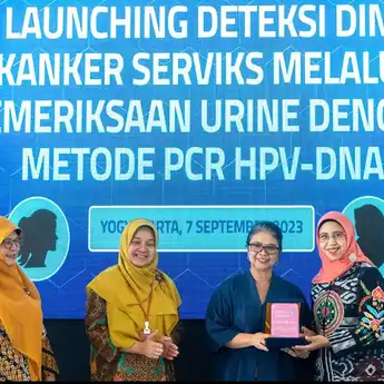 Kerjasama Dengan Pemda DIY, Bio Farma Luncurkan CerviScan