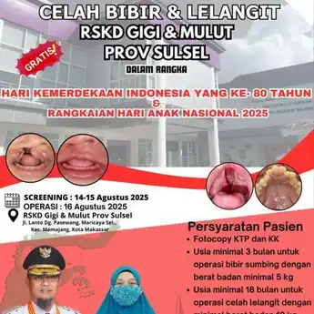 RSKD Sulsel Buka Layanan Operasi Celah Bibir Gratis untuk Anak