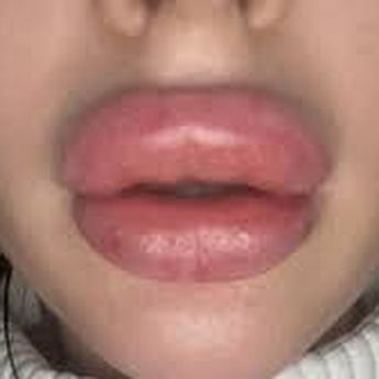 Pengen Punya Bibir Indah Tanpa Suntik Filler Begini Caranya