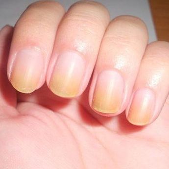 Bagaimana Cara Bersihkan Kuku Kuning Karena Sering Pakai Kutek?