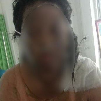 Suami di Lubuk Besar Bangka Tengah  Bakar Istri, Diduga Karena Cekcok Rumah Tangga 