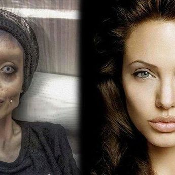 Duh, Ngeri! Ngefans Sampai Rela 50 Kali Operasi Plastik Demi Mirip Persis dengan Angelina Jolie, Begini Kabar Terbaru Keadaan Tubuh Penggemar Sang Aktris Holywood...