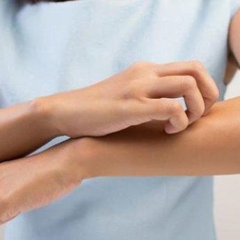 3 Tips Sederhana Menghilangkan Tungau Debu di Rumah, Apa Sajakah? 