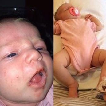 Awas! Berikut 4 Risiko Sembarangan Mencium Bayi: Bisa Kena Cacar Air