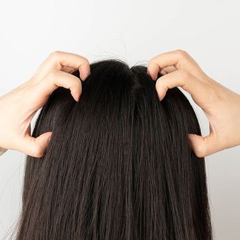 Tips Menghilangkan Luka Borok di Kepala agar Tak Ganggu Penampilan