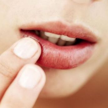 Saat Cuaca Ekstrem, Ini Cara Mengatasi Bibir Kering saat Musim Panas!
