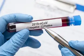 virus corona