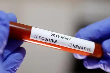 Satu Keluarga di Gianyar positif Covid-19