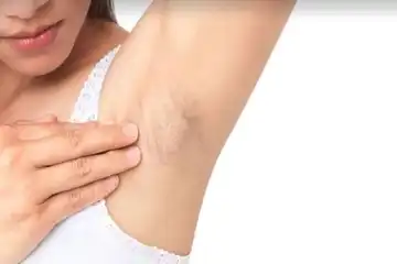 Hati-Hati Jika Ketiak Anda Sering Gatal, Bisa Jadi Pertanda ...