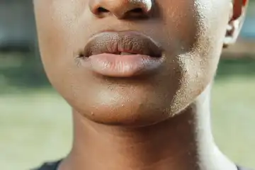 cara atasi bibir pecah-pecah