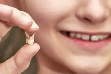Ilustrasi mimpi gigi copot