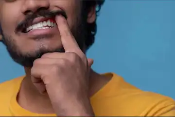 Ilustrasi gusi berdarah.
