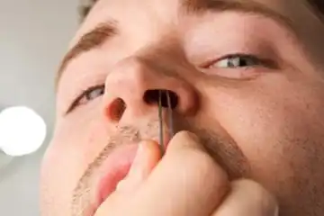 Illustrasi Mencabut Bulu HIdung