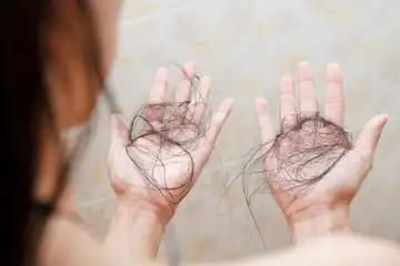 Pernah Mimpi Rambutmu Rontok ? Bisa Jadi Kamu Sedang Cemas - Sonora.id