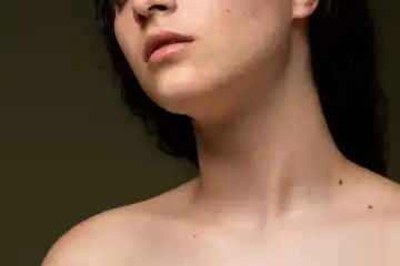 Arti tahi lalat di dada