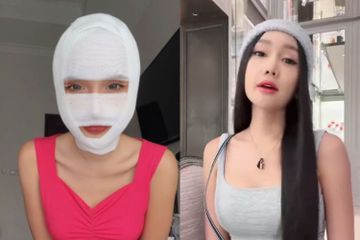 Penampakan Wajah Baru Lucinta Luna Usai 'Ganti Kepala', Beneran ...