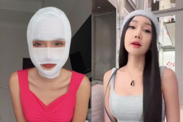 Kabar Duka! Operasi Jakun Lucinta Luna Tidak Selalu Berhasil, Ini ...