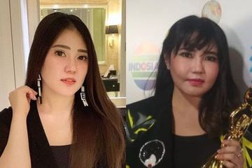 7 Artis Indonesia yang Gagal Operasi Plastik, Bukannya Makin Oke ...