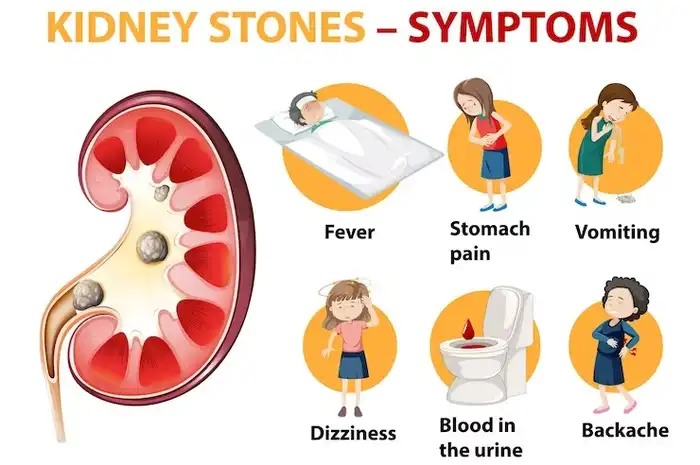 5 Makanan yang Berpotensi Menaikan Resiko Penyakit Batu Ginjal - Sonora.id