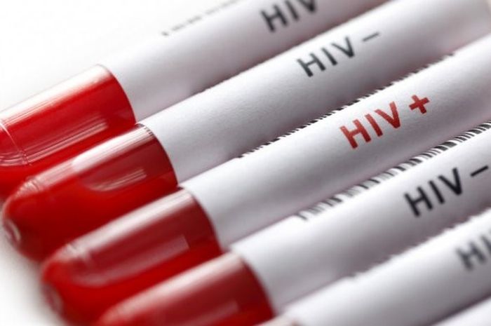 Know and be aware of HIV AIDS from the start, so that the infection can be quickly treated