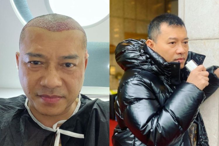 Anang Hermansyah cukur rambut sampai botak. 
