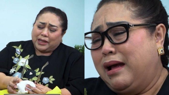 Penampilan Nunung Usai Rambutnya Rontok Akibat Kemoterapi, Tutupi Kepalanya, Mudah Kelelahan 