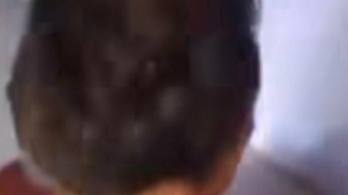 Tangkapan layar video anak-anak laki dari Desa Kulur, Bangka Tengah kena luka melepuh akibat bermain bedil.    