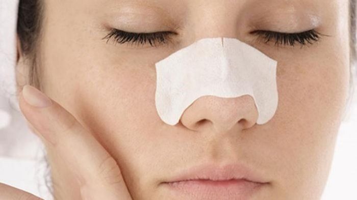 Ilustrasi komedo di hidung