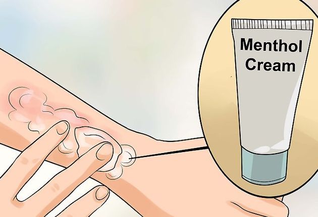 Sering Biduran Berikut Penyebab Biduran Dan Cara Mengatasinya Sonora Id